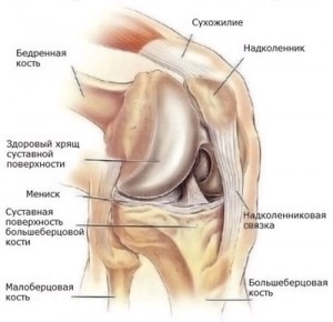 Коленный сустав щелкает при разгибании Коленный сустав щелкает при разгибании