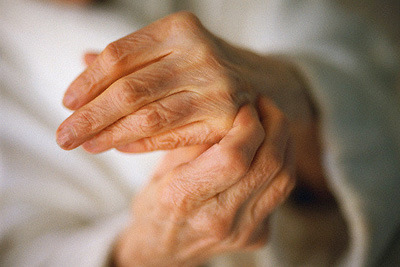 причины возникновения полиартрита пальцев рук