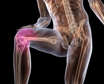 изображение больного колена