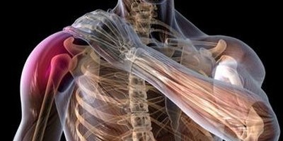 Плексит плечевого сустава – симптомы и лечение народными средствами