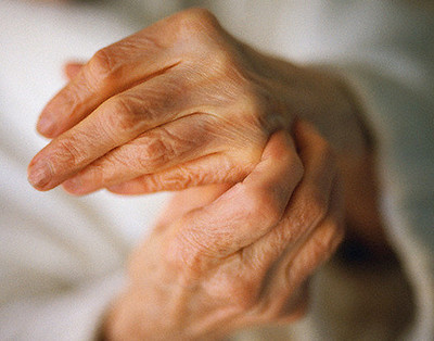 лечение артрита пальцев рук