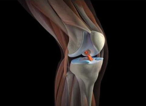 выявление проблемы колена