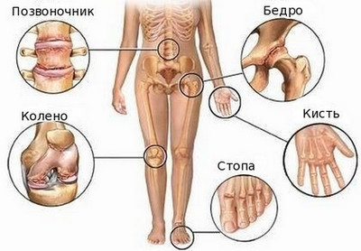 плакат с описанием человеческих суставов