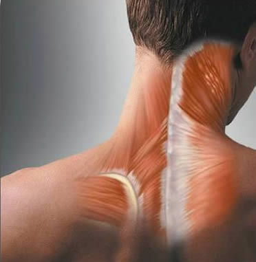 Фото растяжения мышц шеи
