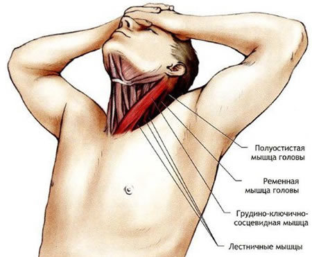 Симптомы растяжения мышц шеи