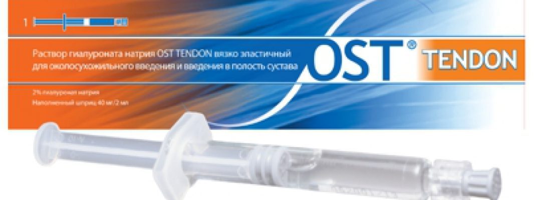 ОстТендон — новый подход к лечению суставов и сухожилий
