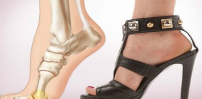 Избавление от болей в суставах и коленях: действенное и недорогое средство