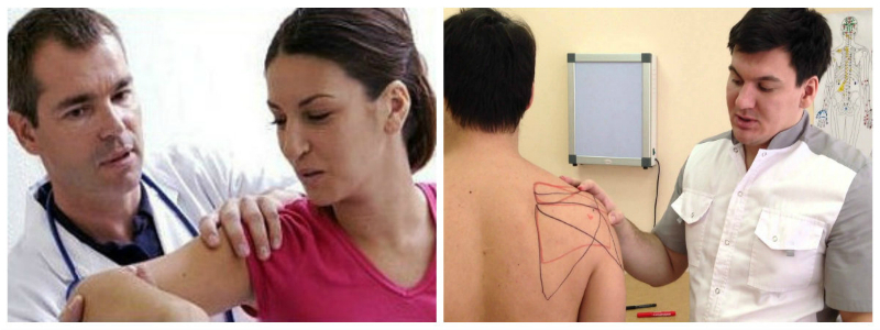 Диагностика защемления плечевого нерва