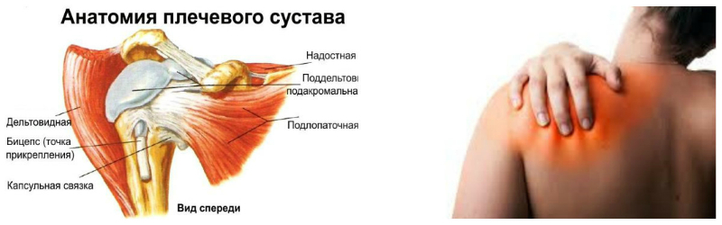 Причины болезни защемления плечевого нерва