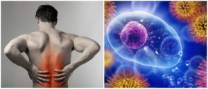 Причины появления миозита мышц спины