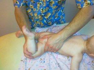 дисплазия тазобедренного сустава у детей