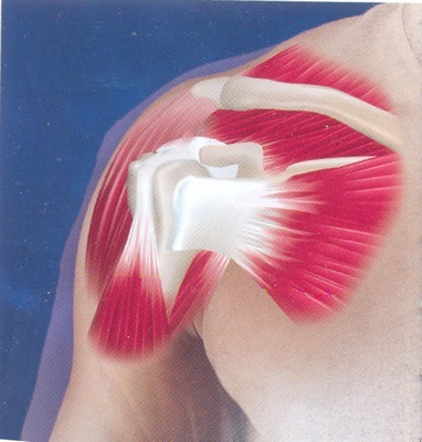 Изображение - Боль в плечевом суставе ограничение движения periartrit3