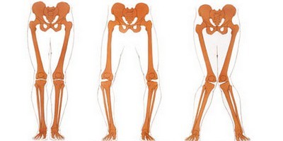 рисунок положений коленного сустава