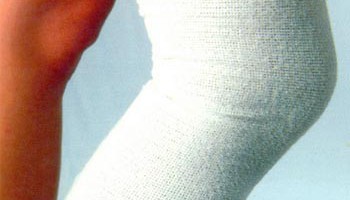 Артроз коленного сустава: пути решения проблемы