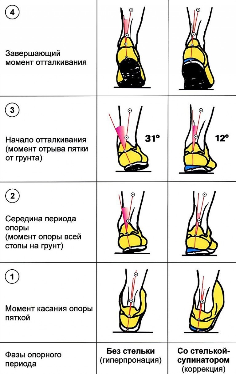 Стопа устроена и функционирует как упругий подвижный