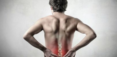 Как и чем лечить миозит мышц спины? Мази, лекарства, народные средства..
