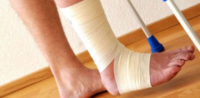 Возможен ли перелом голеностопного сустава, если шевелятся пальцы на ногах?