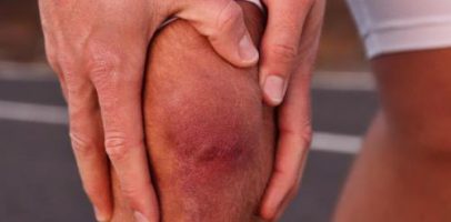 Почему при сильной нагрузке болит поврежденное колено?